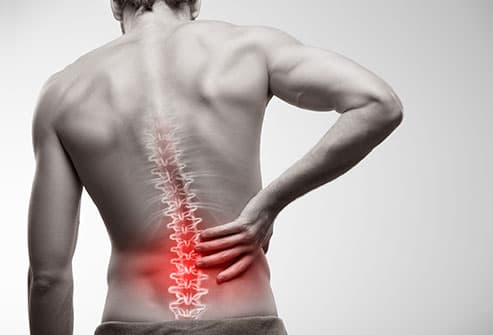 What is Antalgic Scoliosis?