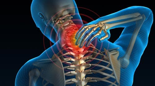 Is Every Lower Back and Neck Pain a Hernia?